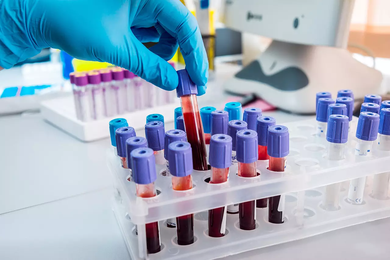 Клинический и биохимический анализы крови - основные показатели 