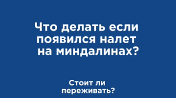 Налет миндалины